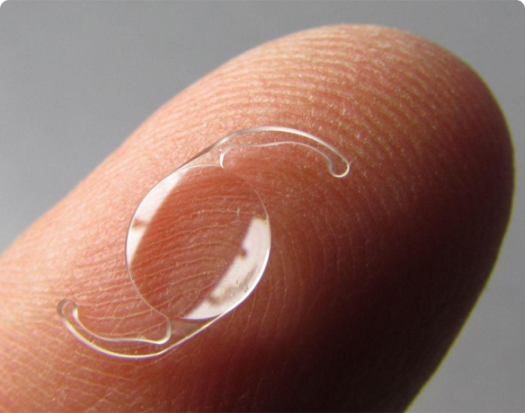 foto sobre as lentes intraoculares